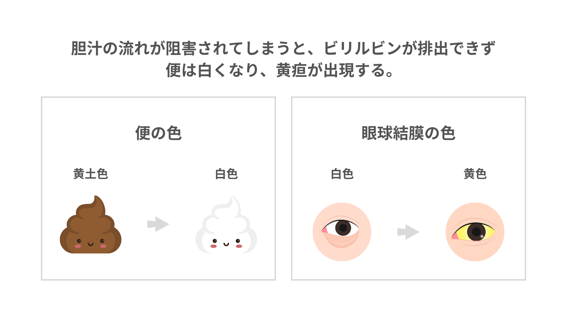 肝臓と胆汁の関係:消化器系の基礎知識 | リトライナース